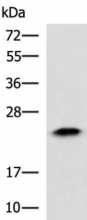 Western blot analysis of Human fetal liver tissue lysate using ABHD14B Polyclonal Antibody at dilution of 1:900