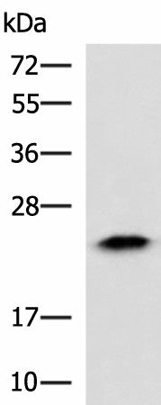 Western blot analysis of Human fetal liver tissue lysate using ABHD14B Polyclonal Antibody at dilution of 1:900