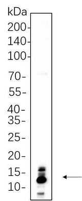 Anti-Human/Mouse/Rat S100B Antibody [B1128]