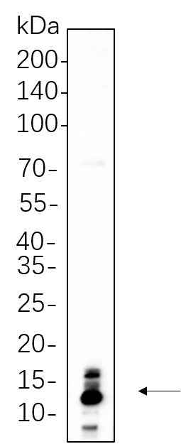 Anti-Human/Mouse/Rat S100B Antibody [B1128] - ABMIUM