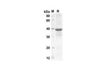 SDS-PAGE analysis of Mouse CCL3 proteins, 2 μg/lane of Recombinant Mouse CCL3 proteins was resolved with an SDS-PAGE under reducing conditions, showing bands at 33.5 kDa.