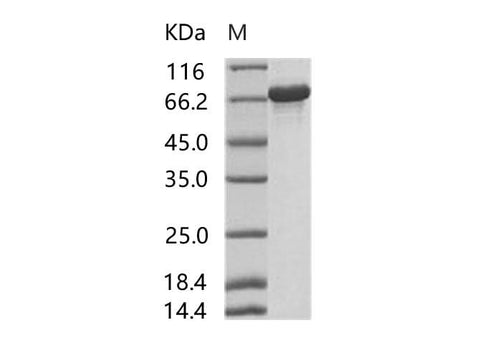 Recombinant HIV-p66 / RT-p66 (group M, subtype B (isolate HXB2) Gag-Pol polyprotein Protein (His Tag) - ABMIUM