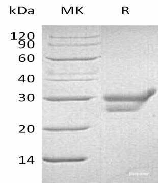Recombinant Human Cathepsin L/CTSL Protein (His Tag) - ABMIUM