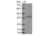 > 80 % as determined by reducing SDS-PAGE.