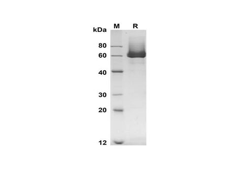 SDS-PAGE analysis of Mouse Mmp8 proteins, 2 μg/lane of Recombinant Mouse Mmp8 proteins was resolved with SDS-PAGE under reducing conditions, showing bands at 60 kDa.