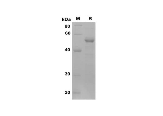 SDS-PAGE analysis of Human HTRA1 proteins, 2 μg/lane of Recombinant Human HTRA1 proteins was resolved with SDS-PAGE under reducing conditions, showing bands at 52 kDa.