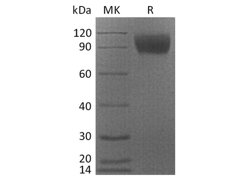 Recombinant Cynomolgus CSF1R/CD115 Protein (His Tag) - ABMIUM