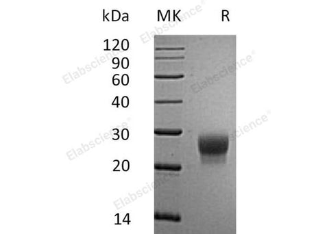 Recombinant Mouse G-CSF/CSF3 Protein (His Tag) - ABMIUM