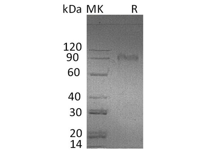 Recombinant Human AMIGO2 Protein (Fc Tag) - ABMIUM