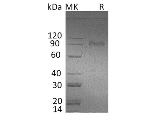 Recombinant Human AMIGO2 Protein (Fc Tag) - ABMIUM