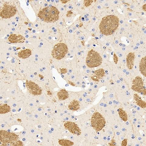 Immunohistochemistry analysis of paraffin-embedded mouse brain using MBP Polyclonal Antibody at dilution of 1:600.