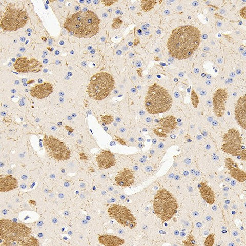 Immunohistochemistry analysis of paraffin-embedded mouse brain using MBP Polyclonal Antibody at dilution of 1:600.
