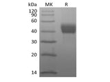 Recombinant Human Tumor-associated Calcium Signal Transducer 2/TROP-2 (C-Avi-6His) Biotinylated - ABMIUM