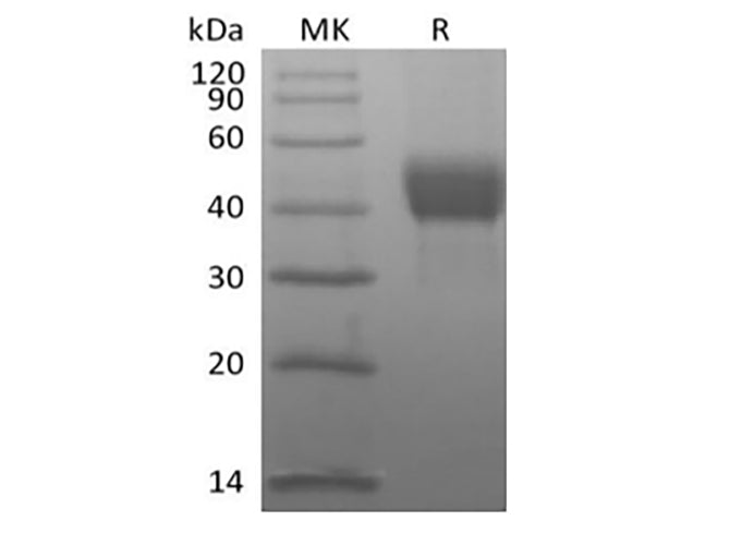 Recombinant Human Tumor-associated Calcium Signal Transducer 2/TROP-2 (C-Avi-6His) Biotinylated - ABMIUM
