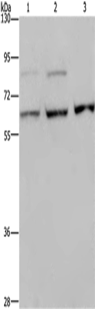 Anti-Human KIF22 Antibody - ABMIUM
