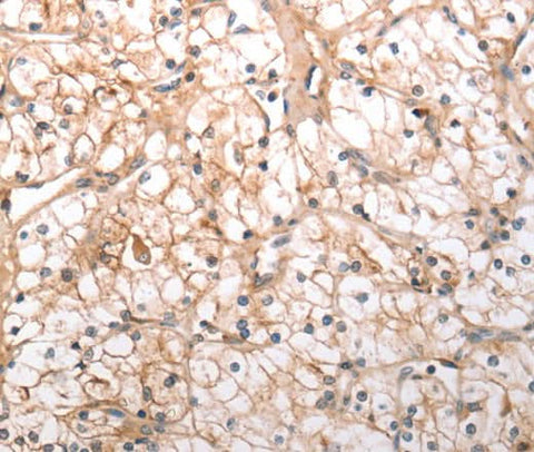 Anti-Human/Mouse/Rat HCRTR1 Antibody - ABMIUM