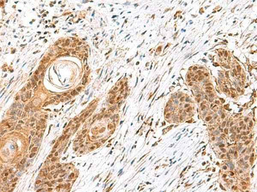 Anti-Human/Mouse/Rat MECR Antibody