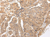 Anti-Human/Mouse CLDND2 Antibody - ABMIUM