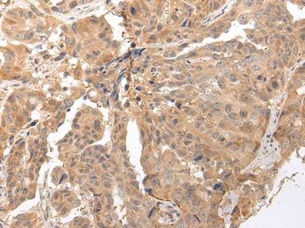 Anti-Human/Mouse CLDND2 Antibody
