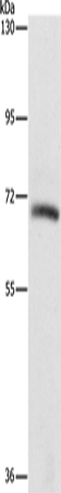 Anti-Human/Mouse/Rat KLC1 Antibody - ABMIUM