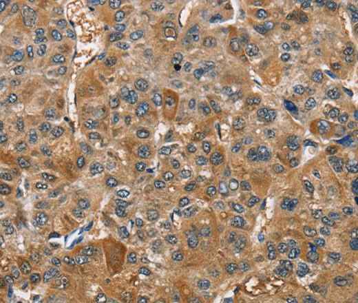 Anti-Human/Mouse TRIP4 Antibody