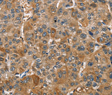 Anti-Human/Mouse TRIP4 Antibody - ABMIUM