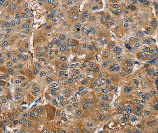 Anti-Human/Mouse TRIP4 Antibody - ABMIUM