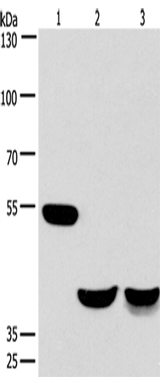 Anti-Human/Mouse CABLES1 Antibody - ABMIUM