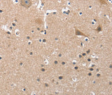 Anti-Human BUB1 Antibody - ABMIUM