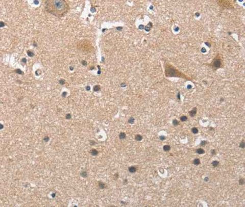 Anti-Human BUB1 Antibody