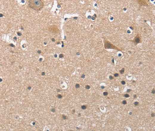 Anti-Human BUB1 Antibody