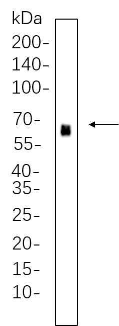 Anti-Human/Mouse/Rat PDPK1 Antibody [B1071] - ABMIUM