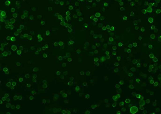 Anti-Human CD86 Antibody [A1117] - ABMIUM
