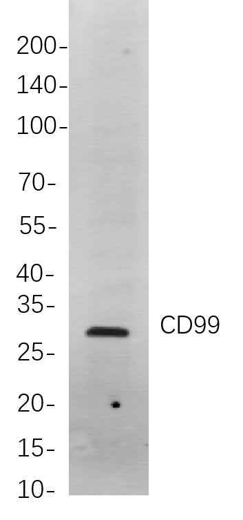 Anti-Human CD99 Antibody [B735] - ABMIUM