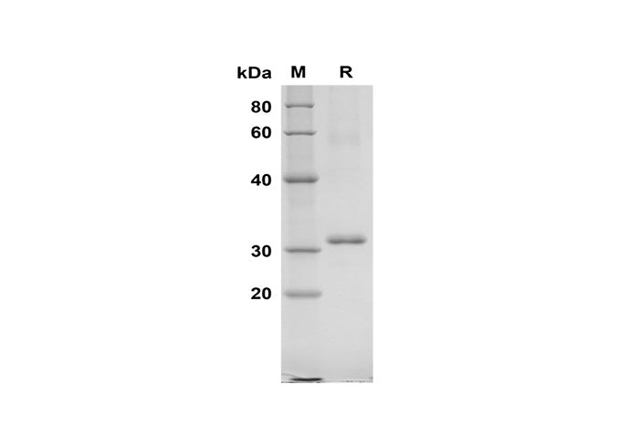 SDS-PAGE analysis of Human KLK7 proteins, 2 μg/lane of Recombinant Human KLK7 proteins was resolved with SDS-PAGE under reducing conditions, showing bands at 31 kDa.