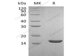 Recombinant Human Lysozyme C/LYZ Protein (His Tag) - ABMIUM