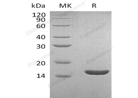 Recombinant Human Lysozyme C/LYZ Protein (His Tag) - ABMIUM