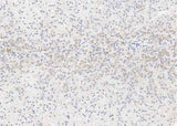Anti-Human ALPL Antibody [A1204] - ABMIUM