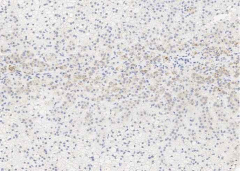 Anti-Human ALPL Antibody [A1204] - ABMIUM