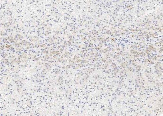 Anti-Human ALPL Antibody [A1204] - ABMIUM