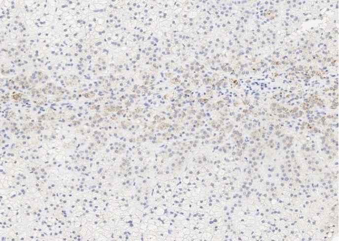 Anti-Human ALPL Antibody [A1204] - ABMIUM
