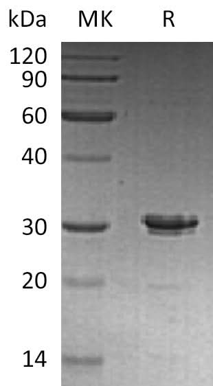 Recombinant Human Syntaxin-6/STX6 Protein - ABMIUM