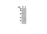 SDS-PAGE analysis of Mouse BAFF R/TNFRSF13C proteins , 2 μg/lane of Recombinant Mouse BAFF R/TNFRSF13C proteins was resolved with SDS-PAGE under reducing conditions , showing bands at 20 kDa.