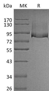 Recombinant Mouse Thrombomodulin/THBD Protein (His Tag) - ABMIUM