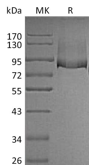 Recombinant Mouse Thrombomodulin/THBD Protein (His Tag) - ABMIUM