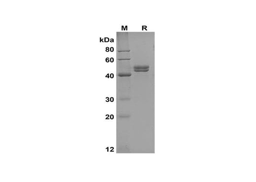 SDS-PAGE analysis of Human IL-17A proteins,2 μg/lane of Recombinant Human IL-17A proteins,was resolved with SDS-PAGE under reducing conditions,showing bands at 45-50 kDa.