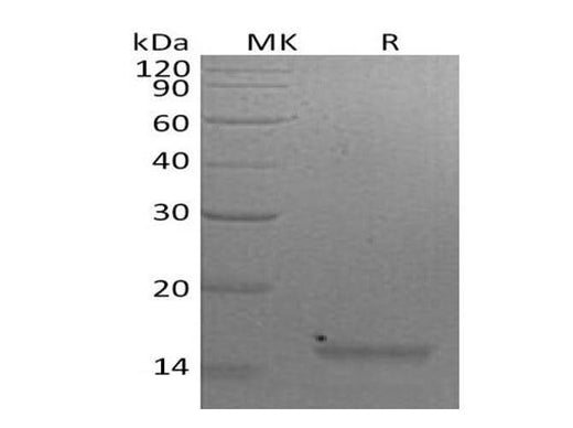 Recombinant Mouse Interleukin-21/IL-21 Protein - ABMIUM