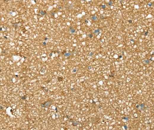 Anti-Human/Mouse/Rat SDC3 Antibody