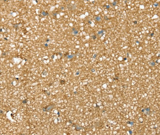 Anti-Human/Mouse/Rat SDC3 Antibody - ABMIUM