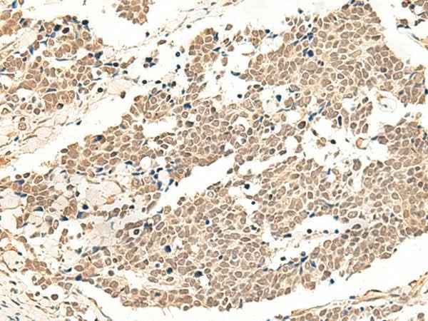 Anti-Human/Mouse/Rat GPR139 Antibody
